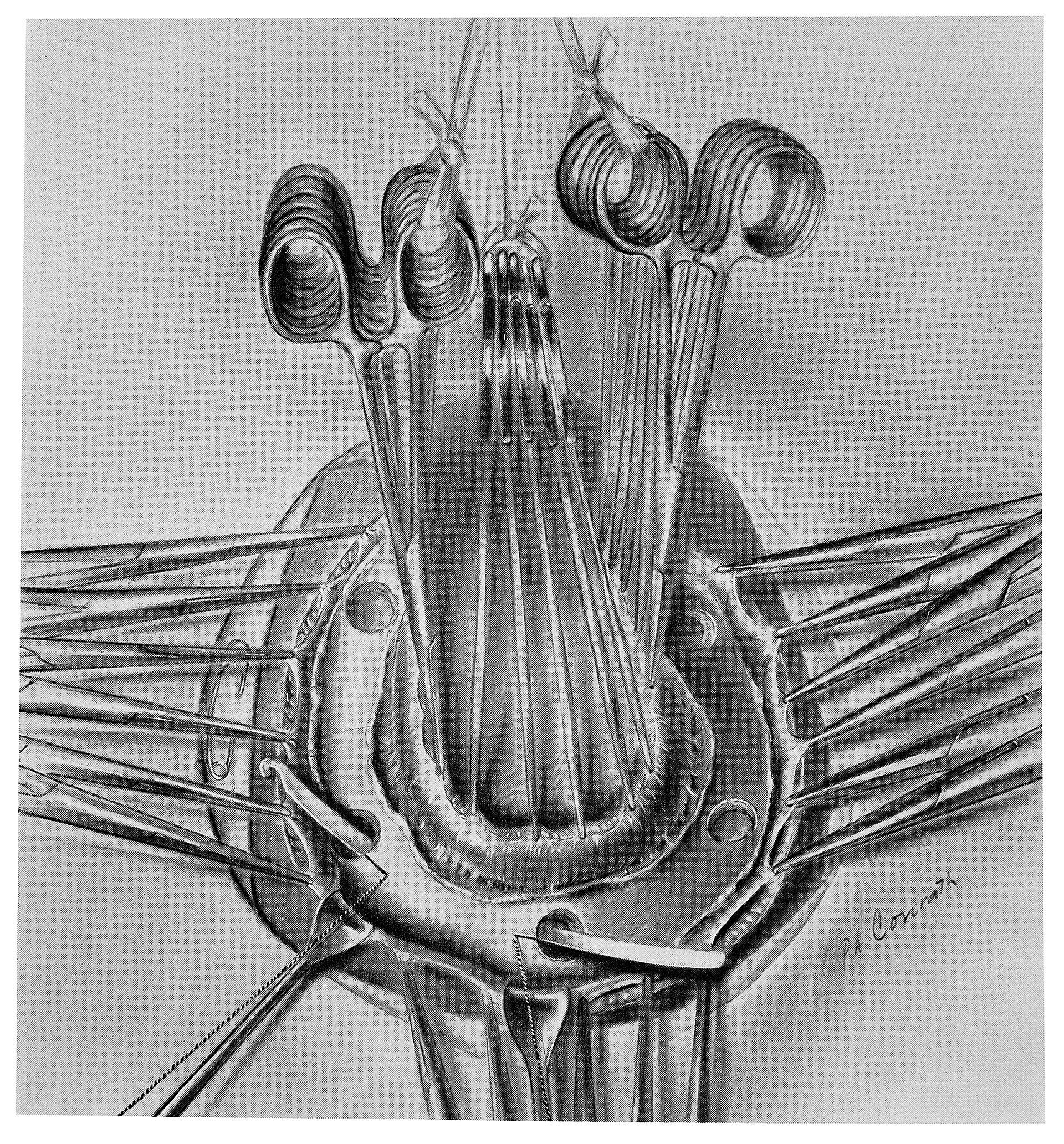 Imagem de referência relacionada a neurocirurgia, item descrito como registro de referência sobre neurocirurgia, organizado a partir de dados estruturados abertos