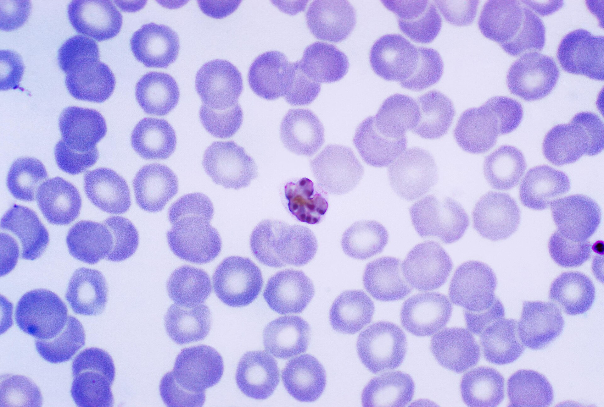 Imagem de referência de Plasmodium malariae, descrito nos dados abertos como plasmodio malarie