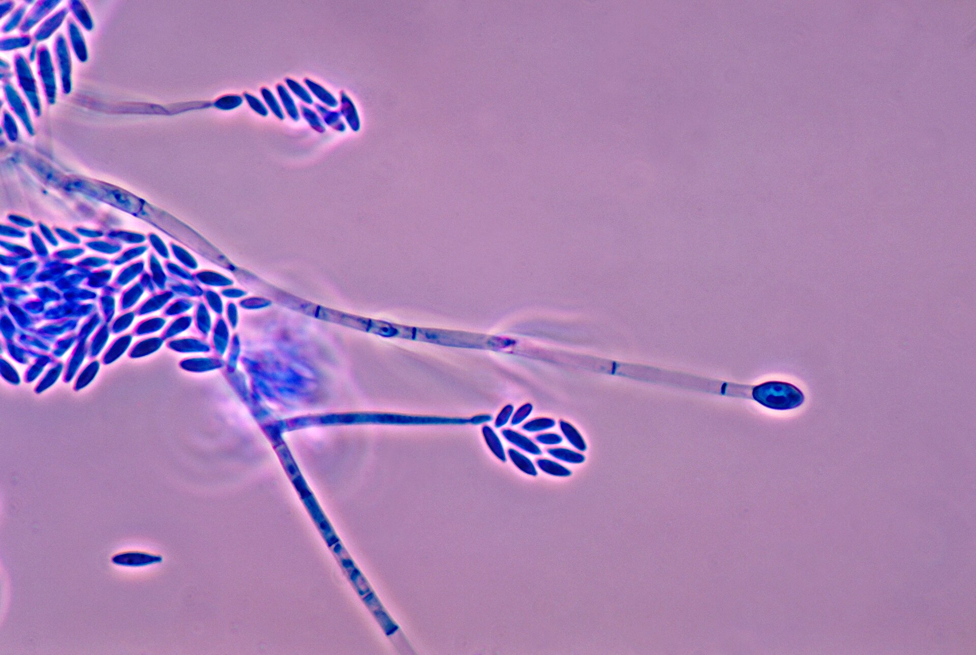 Imagem de referência de Fusarium, descrito nos dados abertos como género de fungos