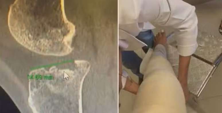 Homem invade vagão feminino e agride passageiras no metrô do DF