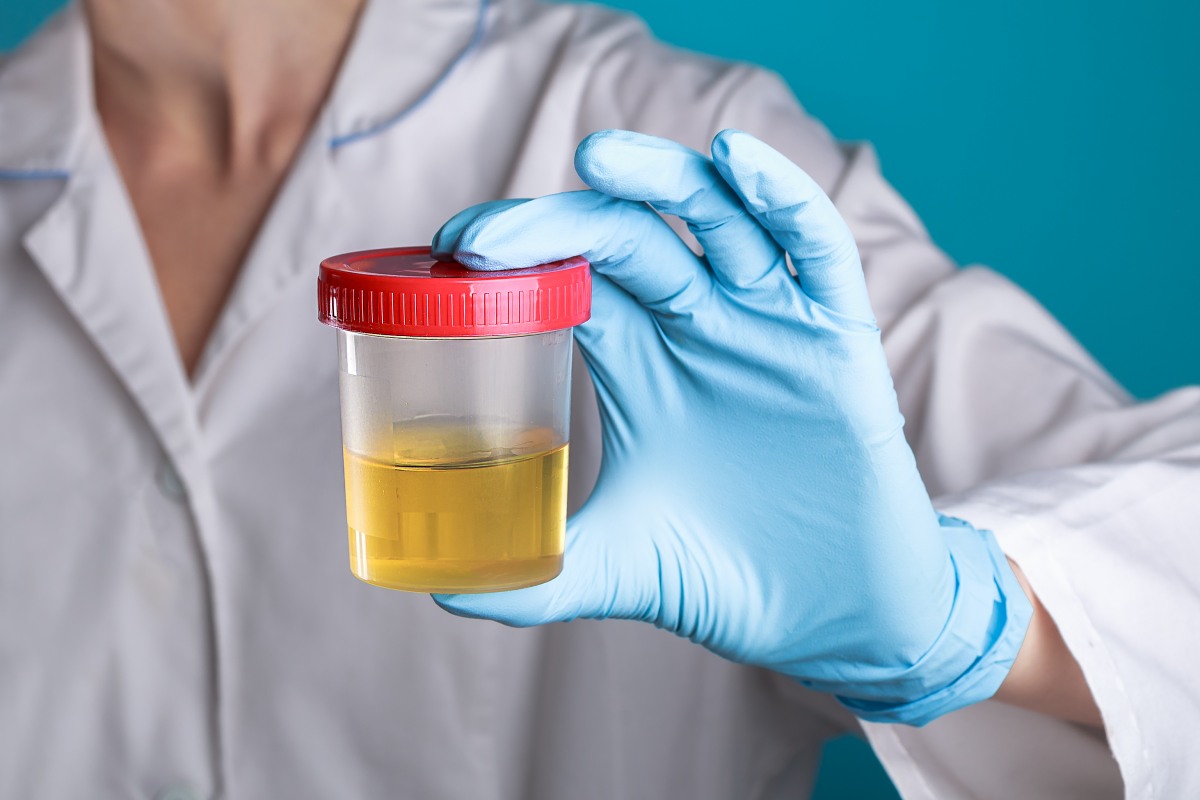 Problema nos rins pode causar pressão alta? Cardiologista explica a relação