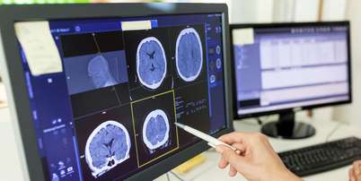Close-up de uma m&eacute;dica analisando o laudo de uma tomografia computadorizada em um monitor de computador Foto: Getty Images / BBC News Brasil
