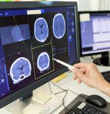 Close-up de uma médica analisando o laudo de uma tomografia computadorizada em um monitor de computador Foto: Getty Images / BBC News Brasil